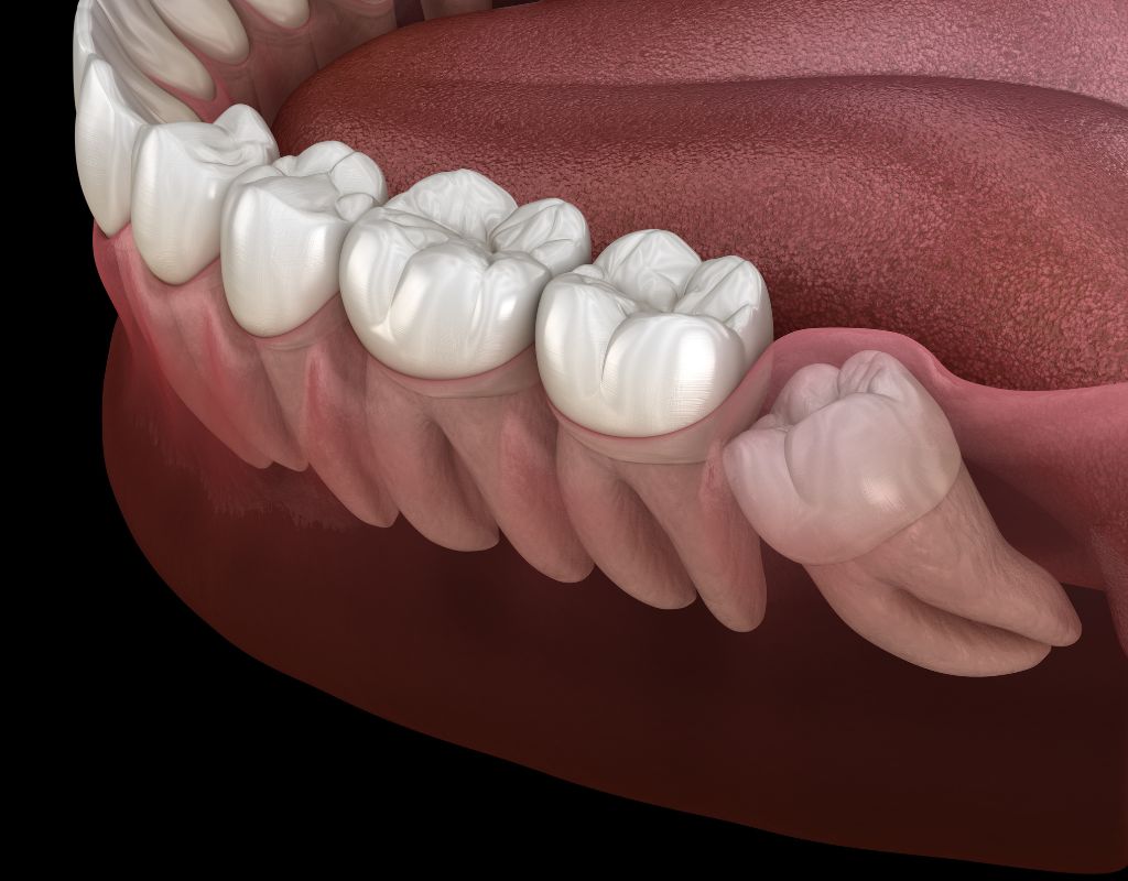 cirurgia medicina oral