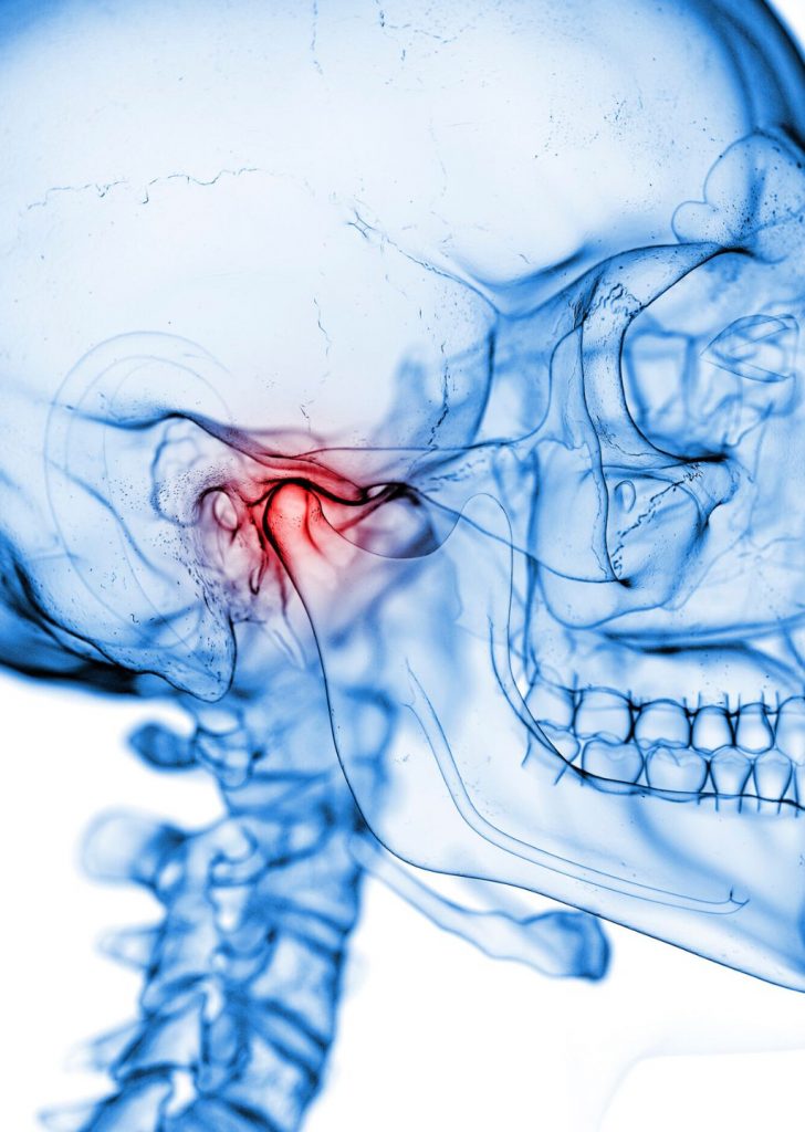 dor orofacial dtm bruxismo